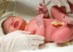 بانک-خون-بند-ناف بانک خون بند ناف