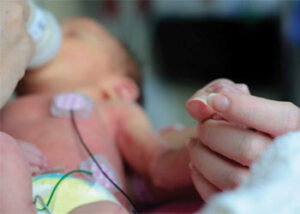 نوزاد-در-بخش-NICU