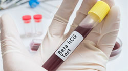 آزمایش بتا در بارداری