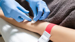 تفسیر آزمایش خون بارداری