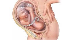 انواع-پرزانتاسیون-جنین انواع پرزنتاسیون جنین