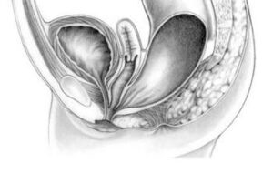 بارداری در رابطه مقعدی
