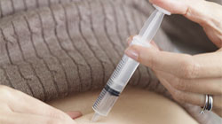 تزریق اچ سی جی برای درمان ناباروری