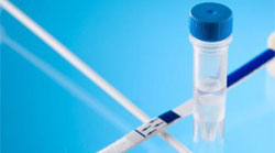 تست آمنی شور برای تشخیص پارگی کیسه آب