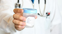 تفسیر آزمایش اسپرم و تحرک اسپرمها