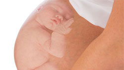 جنین در پوزیشن بریچ