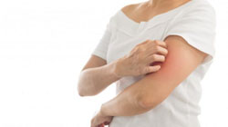 خارش پوست در بارداری