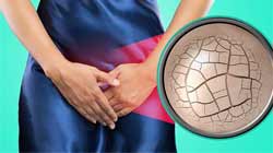 خشکی واژن در حین رابطه