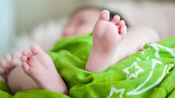 درمان پای پرانتزی نوزاد