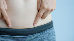 زایمان طبیعی بعد از سزارین