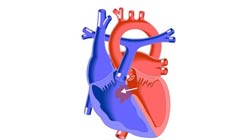 سوراخ قلب نوزاد