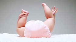 علائم حساسیت کودک به پوشک