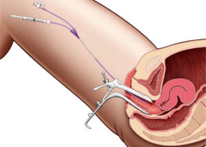 عکس رنگی رحم
