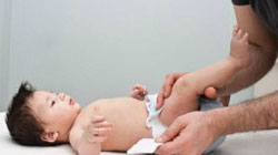 مراقبت از دستگاه تناسلی نوزاد پسر