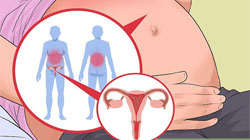 نارسایی-دهانه-رحم-در-بارداری نارسایی دهانه رحم در بارداری