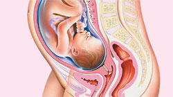 پرزنتاسیون-سفالیک-جنین-در-رحم پرزنتاسیون سفالیک جنین در رحم