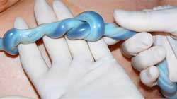 گره-بند-بند-ناف-دور-گردن-جنین گره بند ناف دور گردن جنین